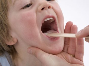 Morbillo, tonsille e ruttini
