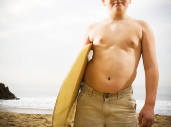 Globesity: l’epidemia di obesità colpisce anche i bambini