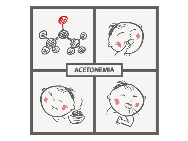 acetone bambini acetonemia cosa fare